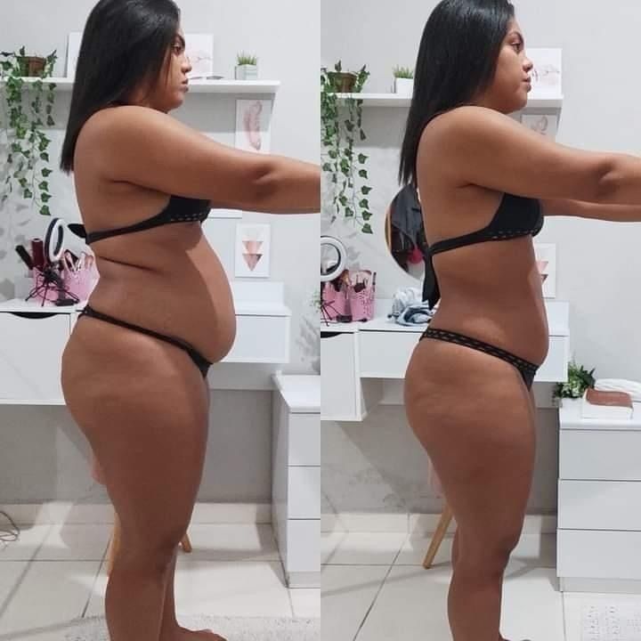 antes e depois 2
